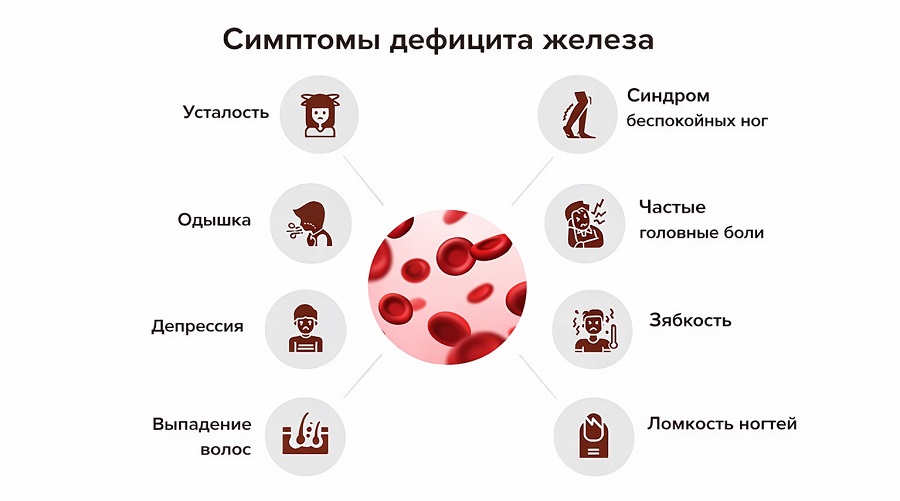 Симптомы дефицита железа