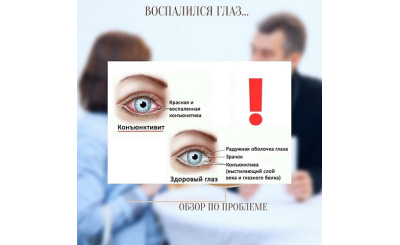 Воспаление слизистой оболочки глаза 